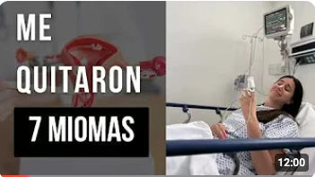 Miomas cirugía